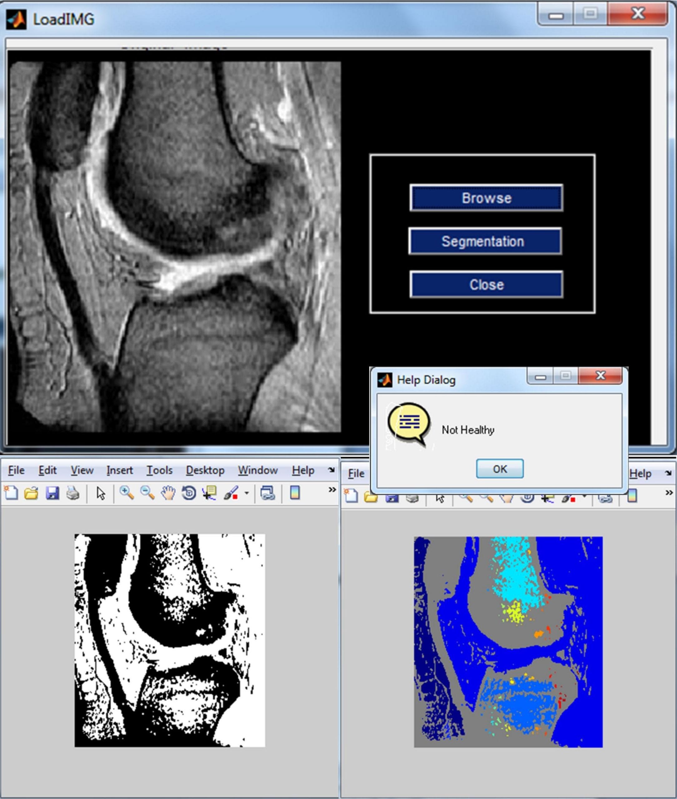 PhD Projects in Biomedical Engineering 3 PhD Projects in Biomedical Engineering