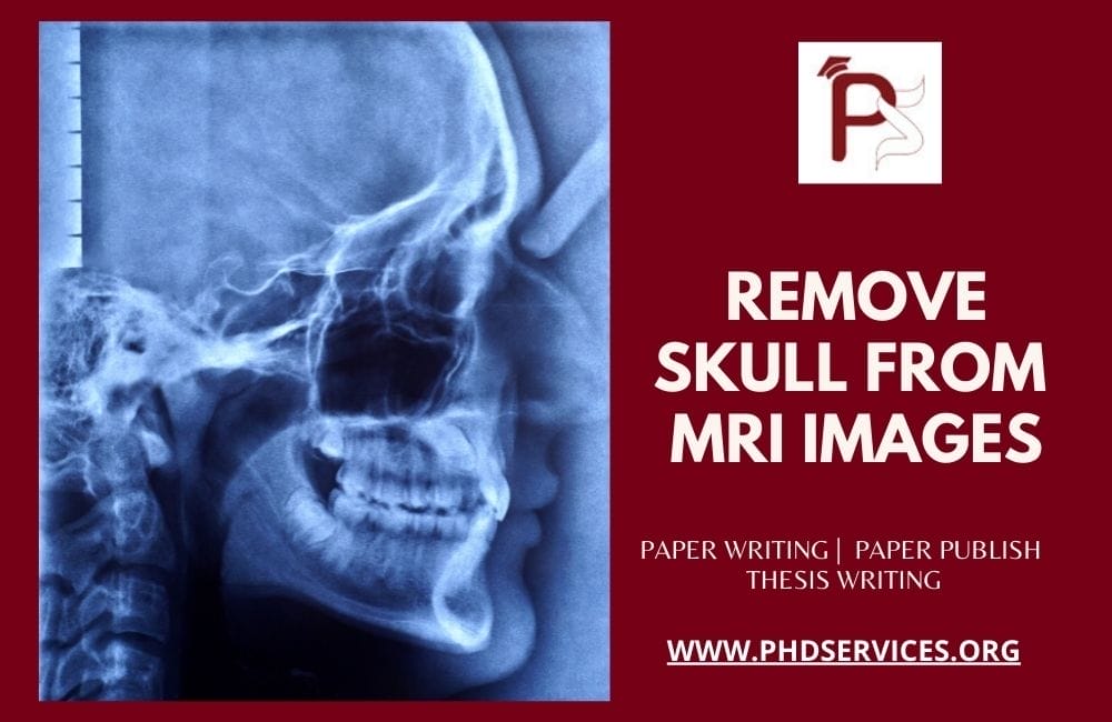 Remove Skull from MRI Images 1 Remove Skull from MRI Images Research Guidance