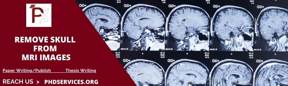 Remove Skull from MRI Images 2 Research Guidance to implement Remove Skull From MRI Images